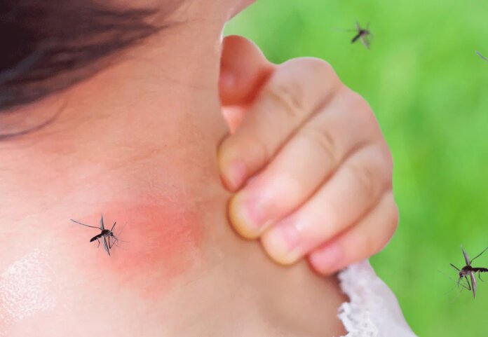 Rimedi Naturali per Allontanare le Zanzare