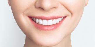 Sbiancare i Denti in Modo Naturale