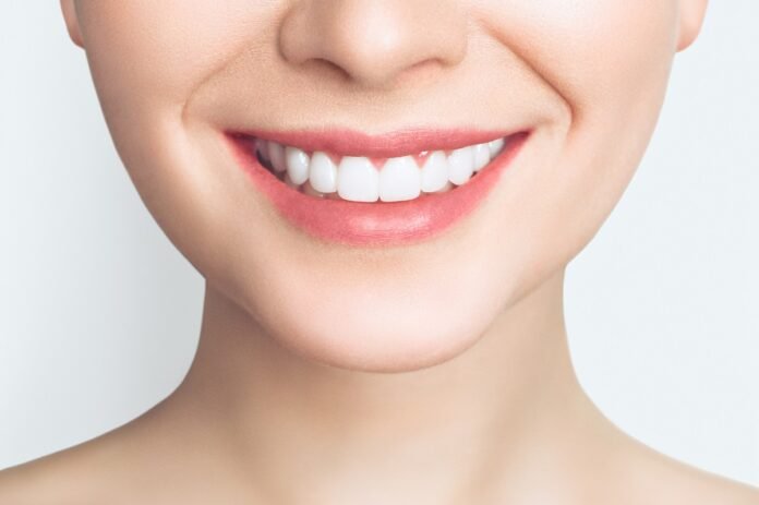Sbiancare i Denti in Modo Naturale