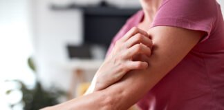 Rimedi Naturali per Alleviare il Prurito da Sudore