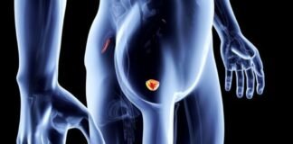 Prostata